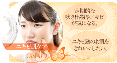 ニキビ肌ケア 定期的な吹き出物やニキビが気になる。 ニキビ跡のお肌をきれいにしたい。
